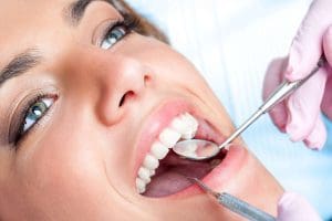 Deep Cleaning And Regular Cleaning | 714-986-1699 | Dentique