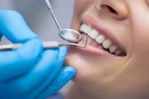 Teeth Cleaning For Braces | 714-986-1699 | Dentique