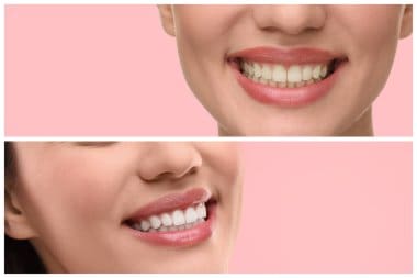 Cosmetic Dentistry Near Me: Enhance Your Smile with Local Experts
