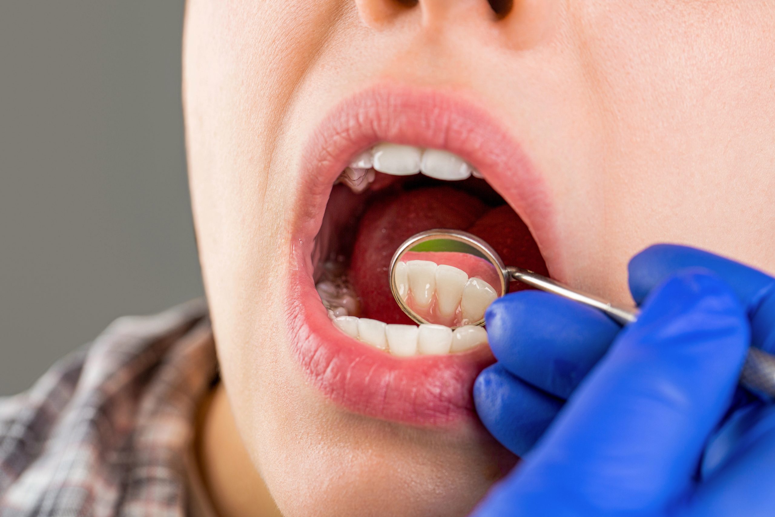 Dental Implant for Missing Molar: Restoring Function Where It Matters Most