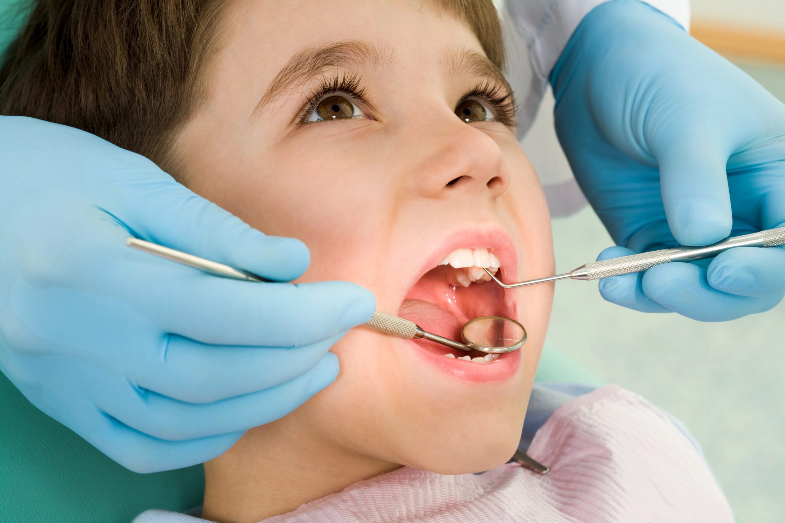 Essential Sealants and Children Dental Cleanings for Kids in Yorba Linda CA to Provide Extra Protection Against Decay